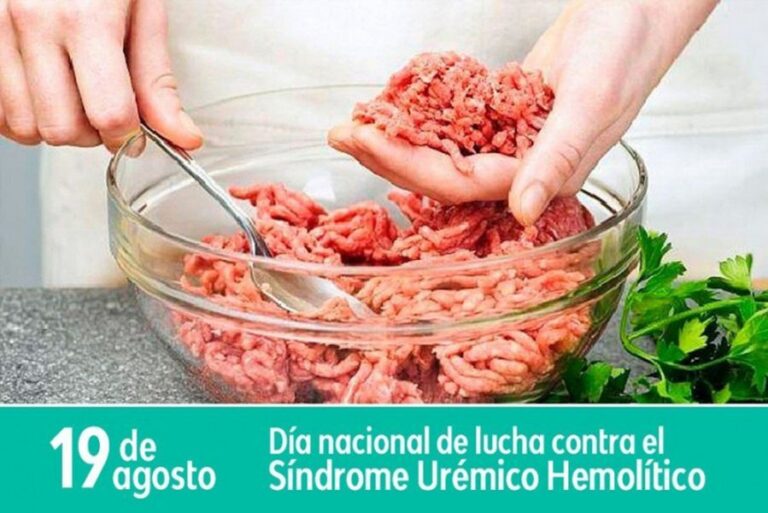 Carnes bien cocidas y vegetales bien lavados previenen síndrome urémico hemolítico